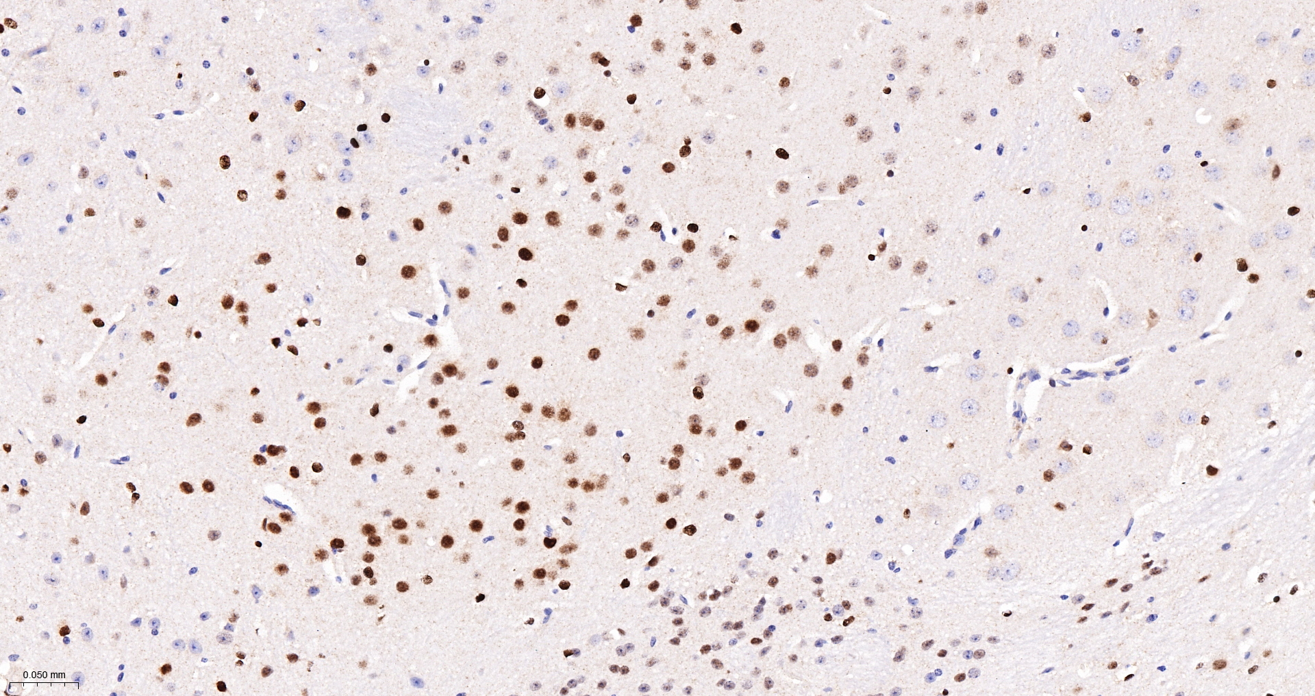 SOX2 Monoclonal Antibody