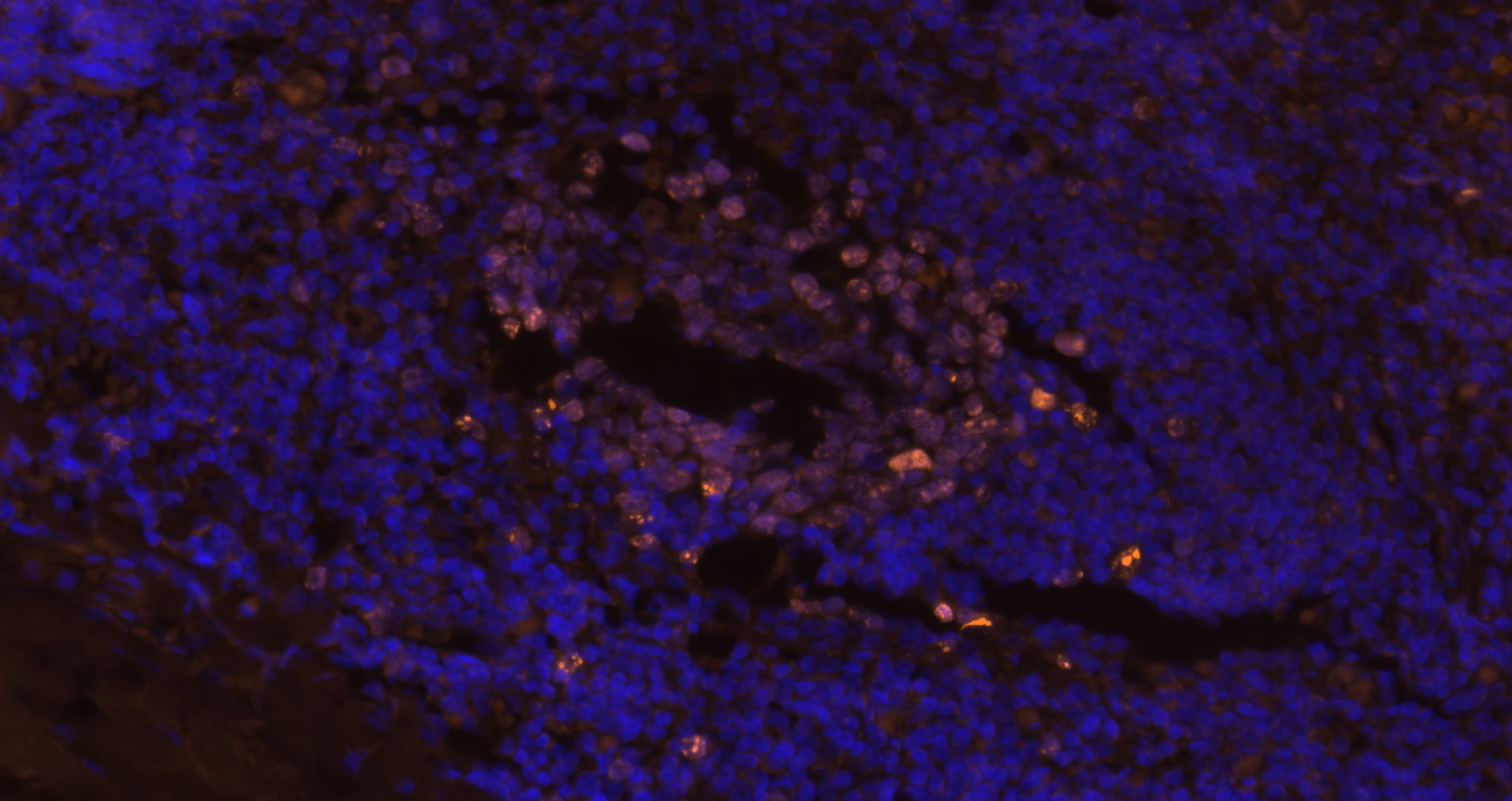 Ki-67 Polyclonal Antibody, Cy3 Conjugated
