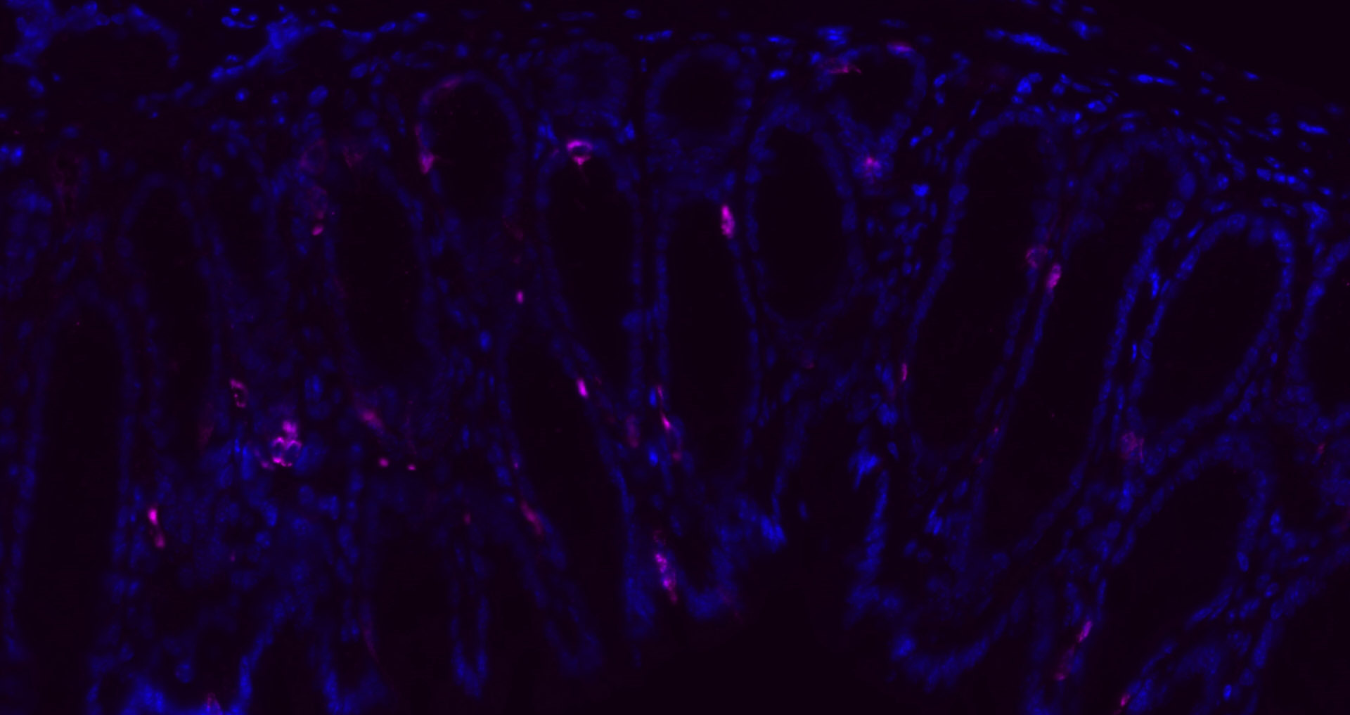 CHGA Polyclonal Antibody, Cy5 Conjugated