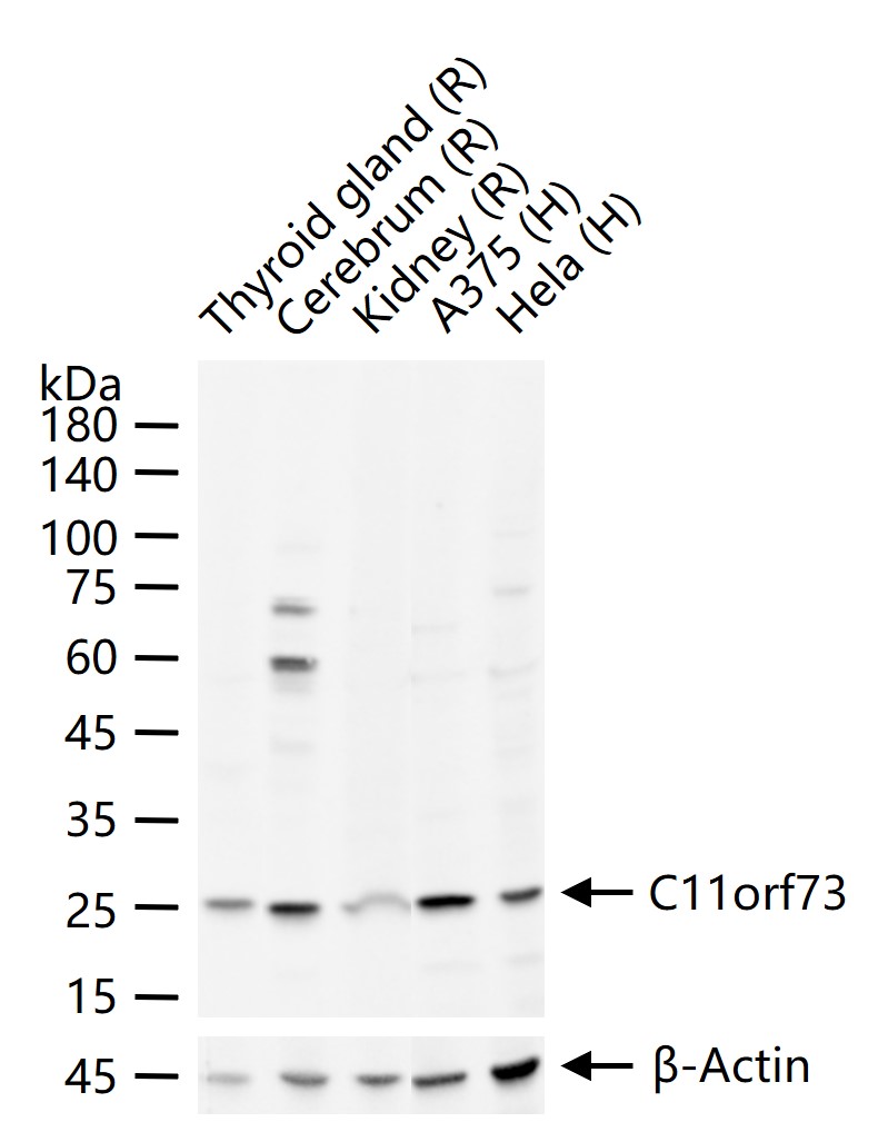 C11orf73 Polyclonal Antibody