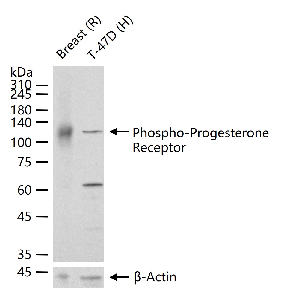 Phospho-Progesterone Receptor (Ser190) Polyclonal Antibody