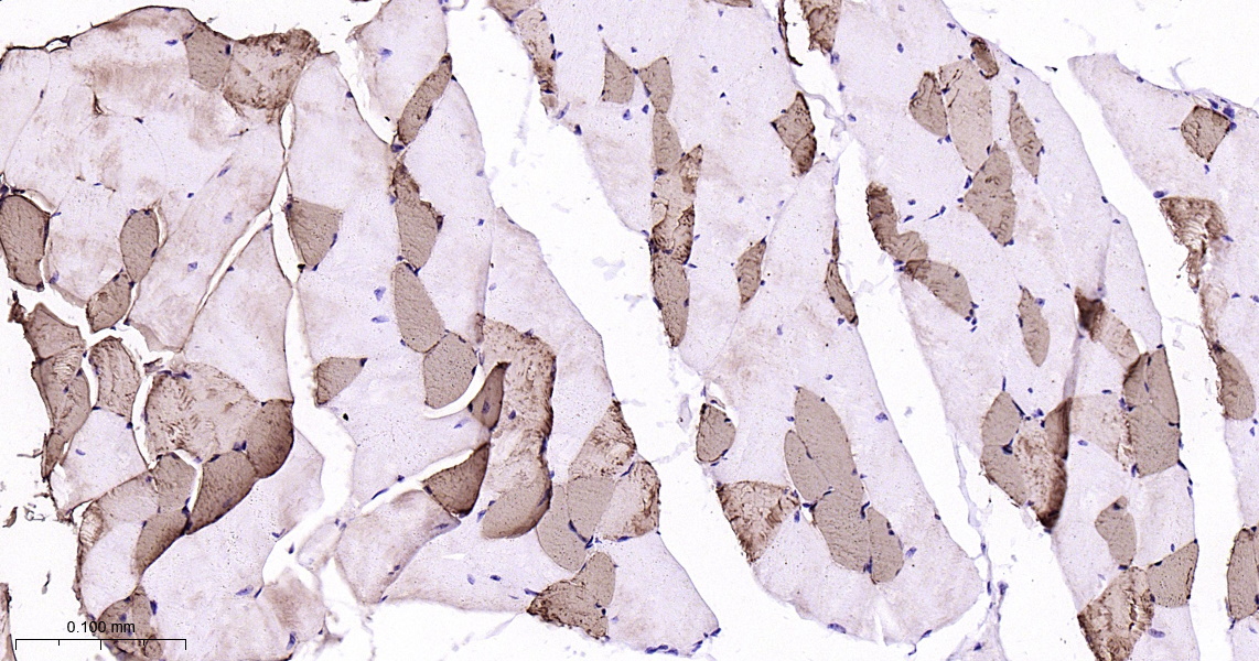 Myoglobin Recombinant Antibody