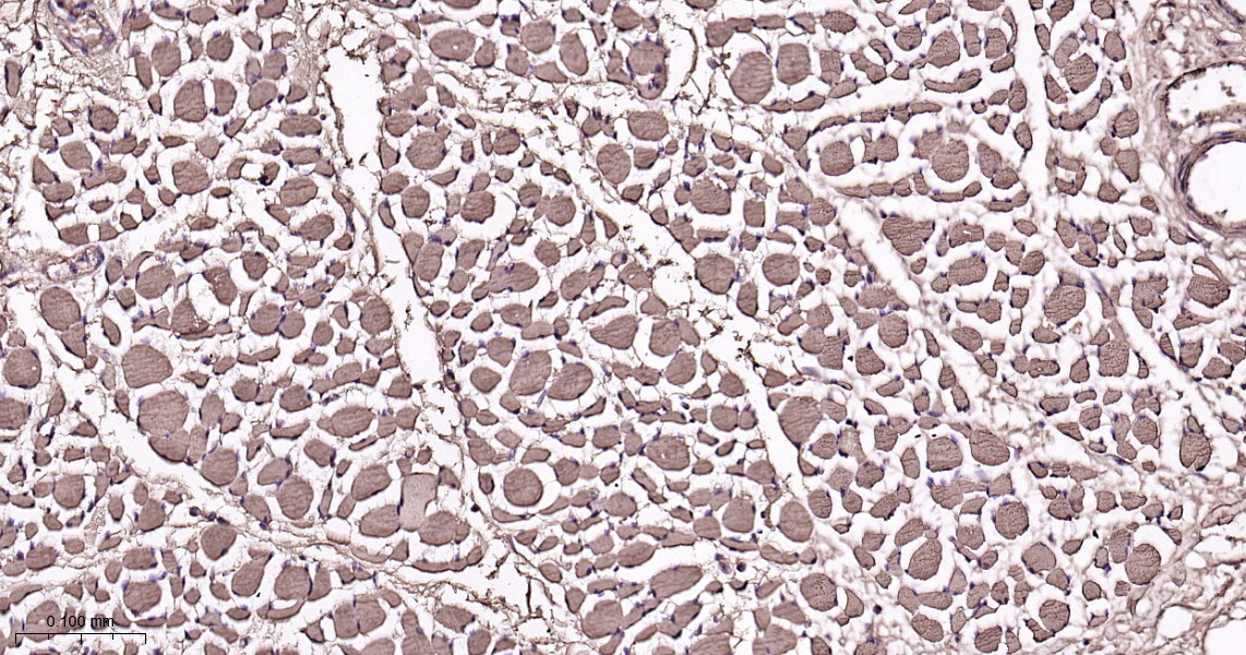 Myoglobin Recombinant Antibody