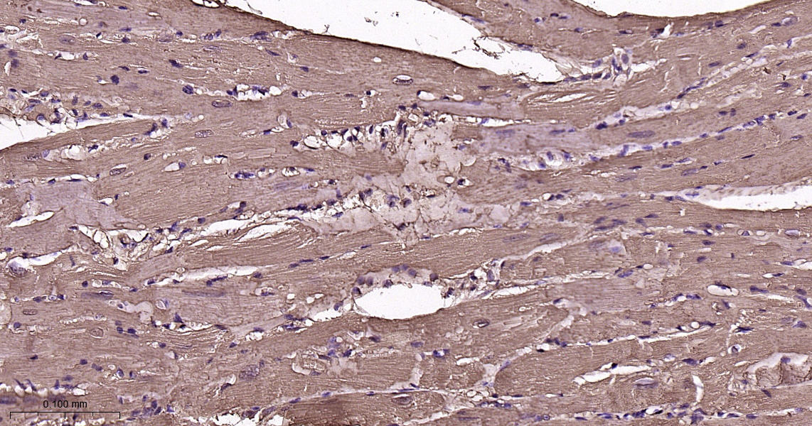Myoglobin Recombinant Antibody