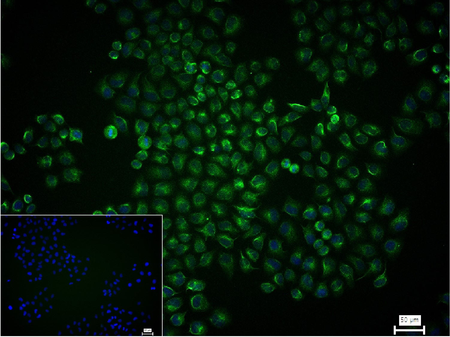 Vimentin Polyclonal Antibody, FITC Conjugated