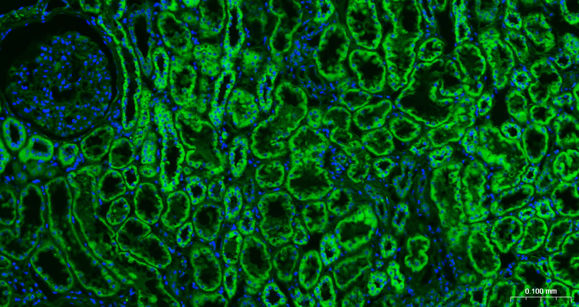 Calreticulin Polyclonal Antibody, FITC Conjugated