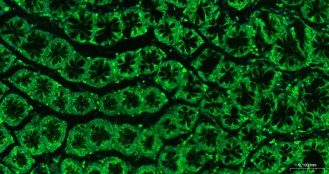 Calreticulin Polyclonal Antibody, FITC Conjugated