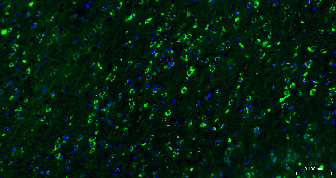 Calreticulin Polyclonal Antibody, FITC Conjugated