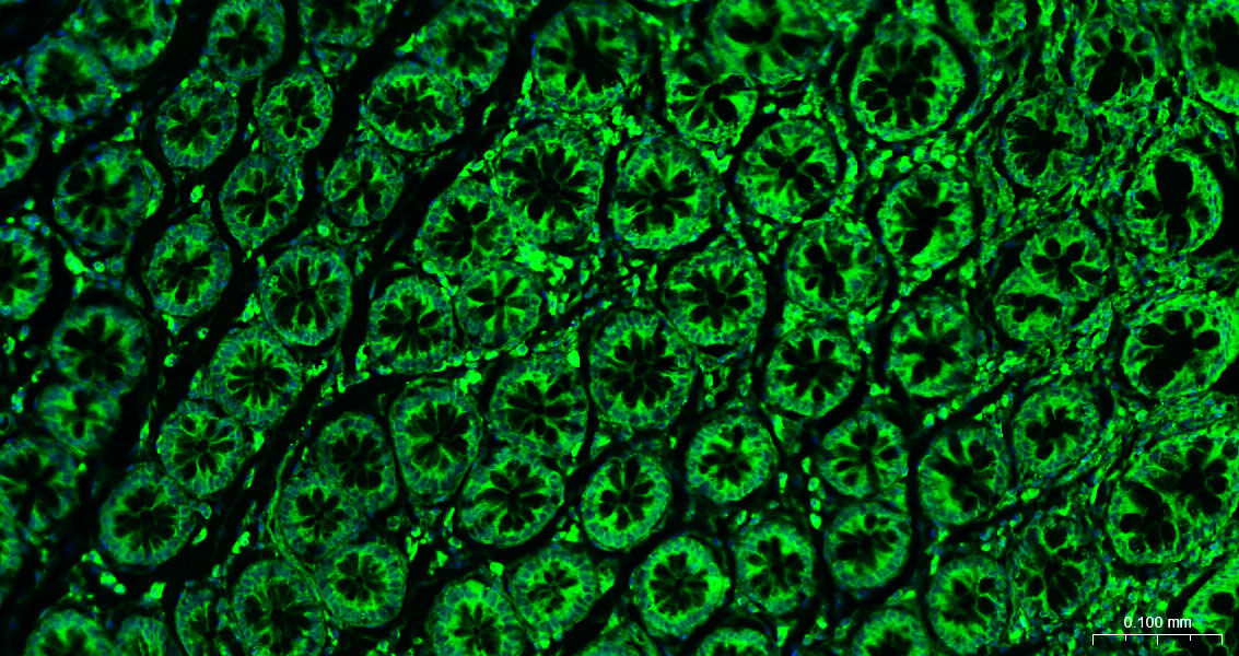 Calreticulin Polyclonal Antibody, AbBy Fluor-488 Conjugated