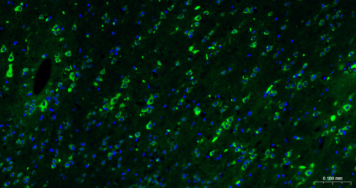 Calreticulin Polyclonal Antibody, AbBy Fluor-488 Conjugated