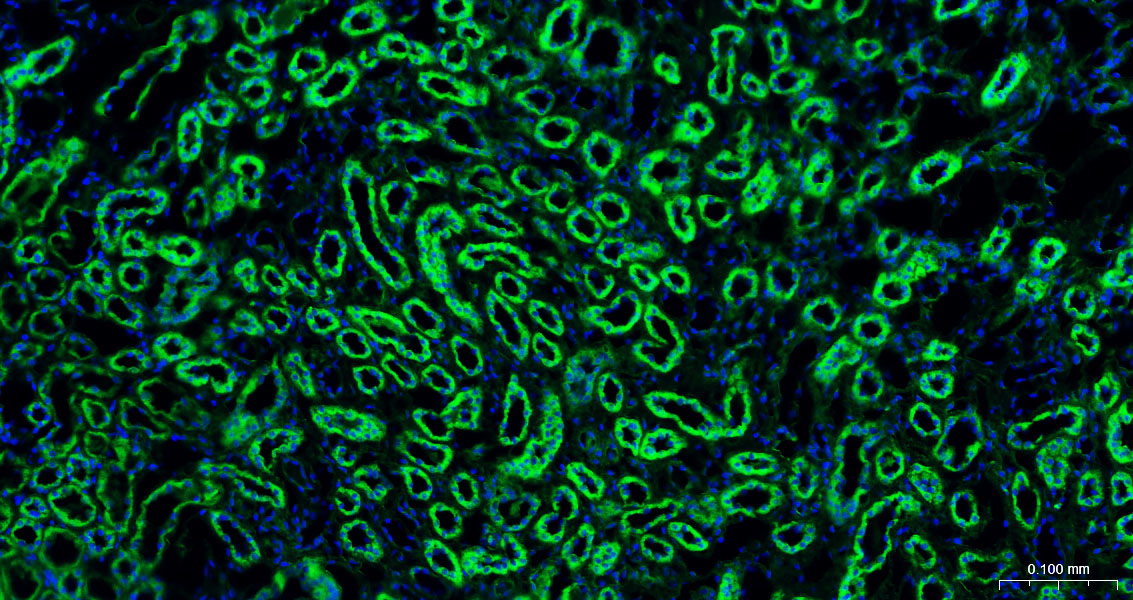 Calreticulin Polyclonal Antibody, AbBy Fluor-488 Conjugated