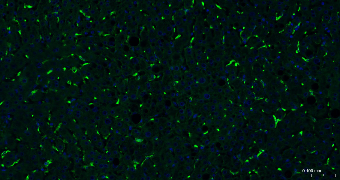 CD163 Monoclonal Antibody
