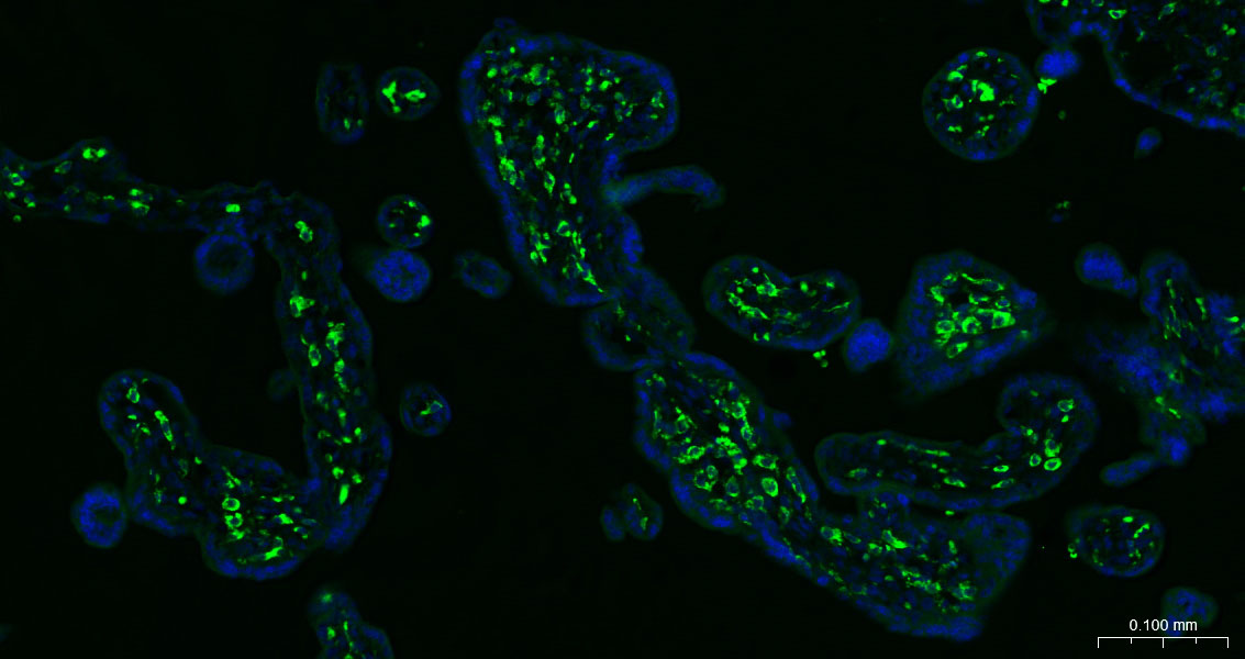 CD163 Monoclonal Antibody