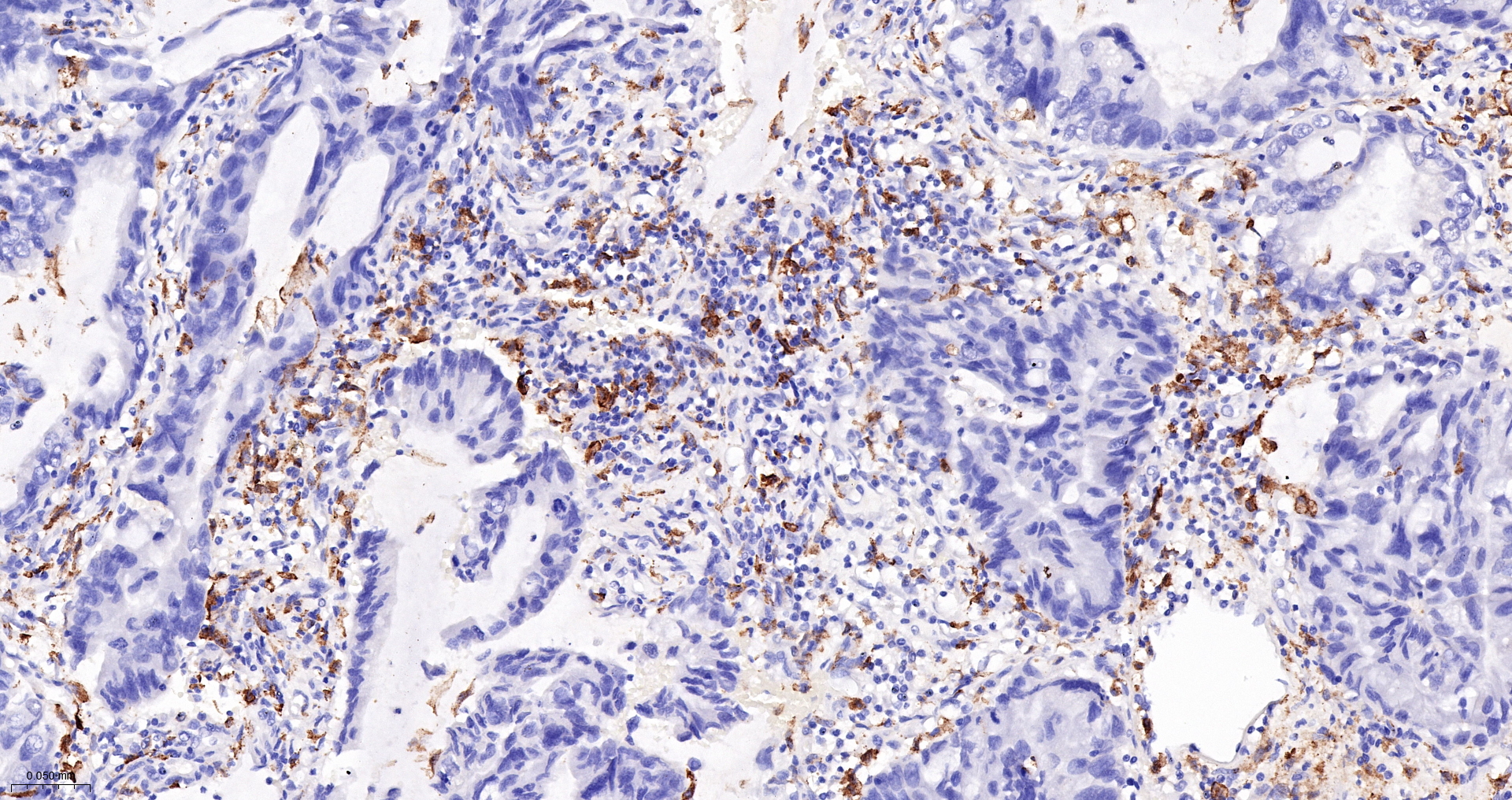 CD163 Monoclonal Antibody