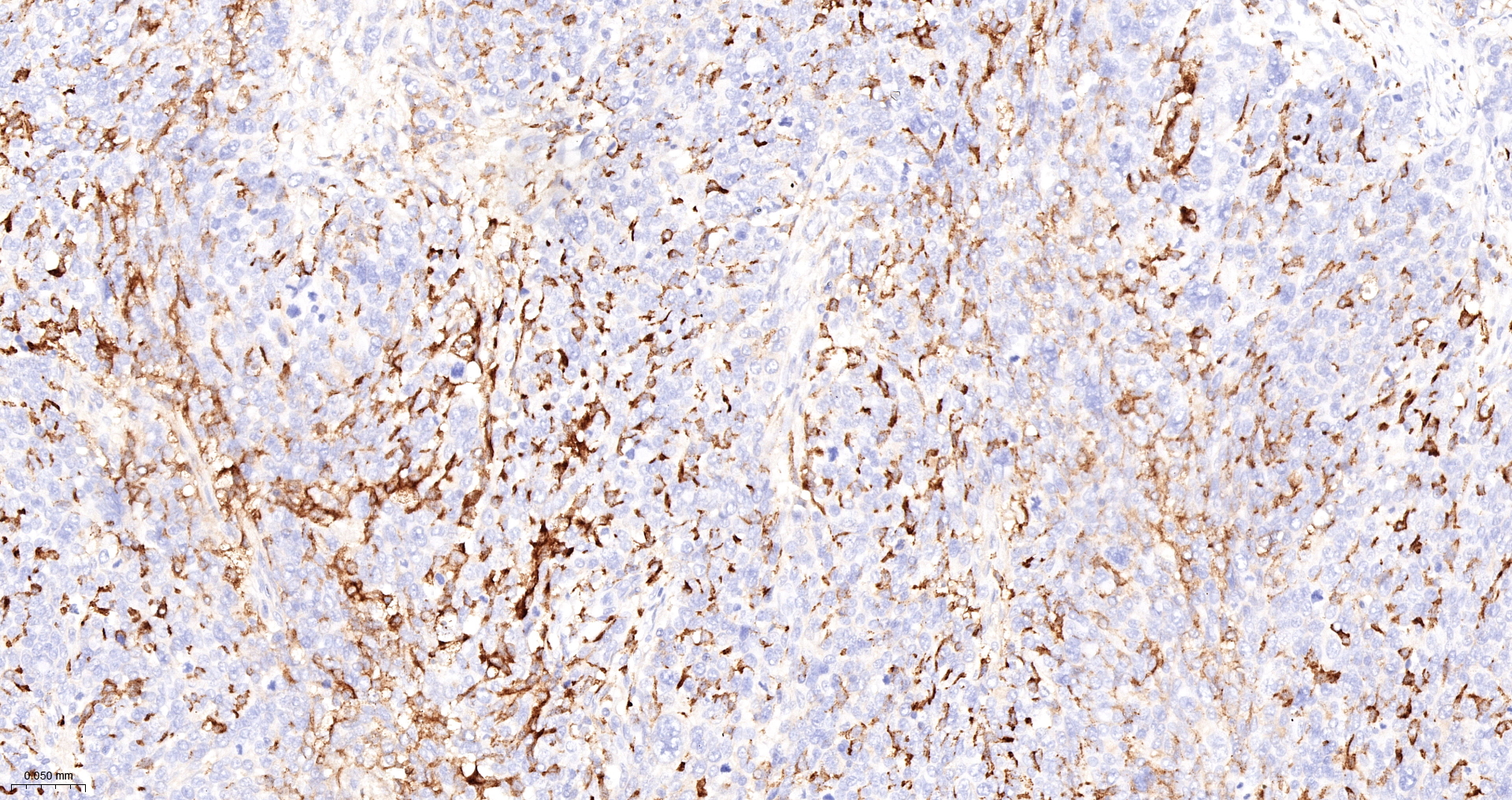 CD163 Monoclonal Antibody