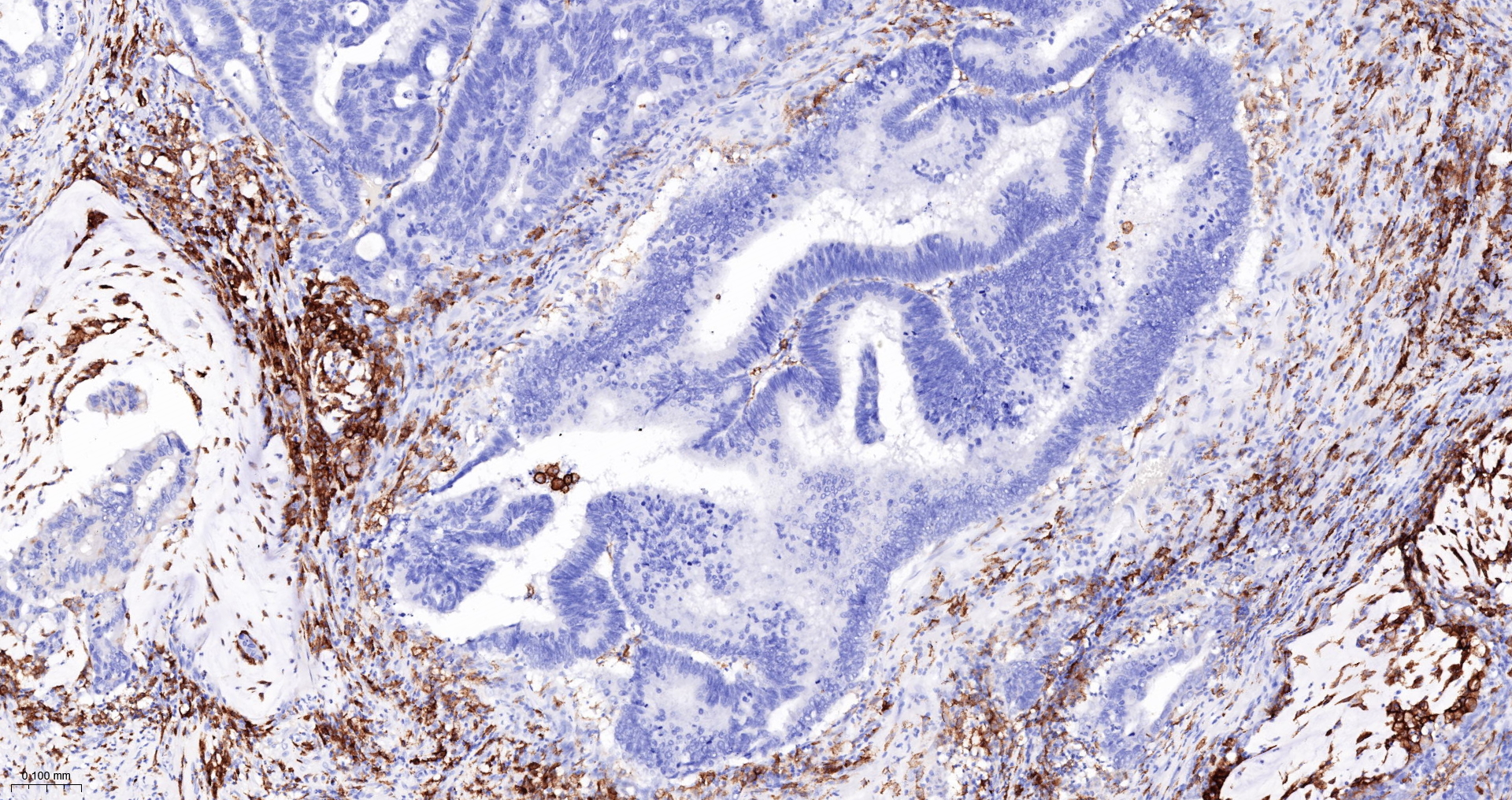 CD163 Monoclonal Antibody