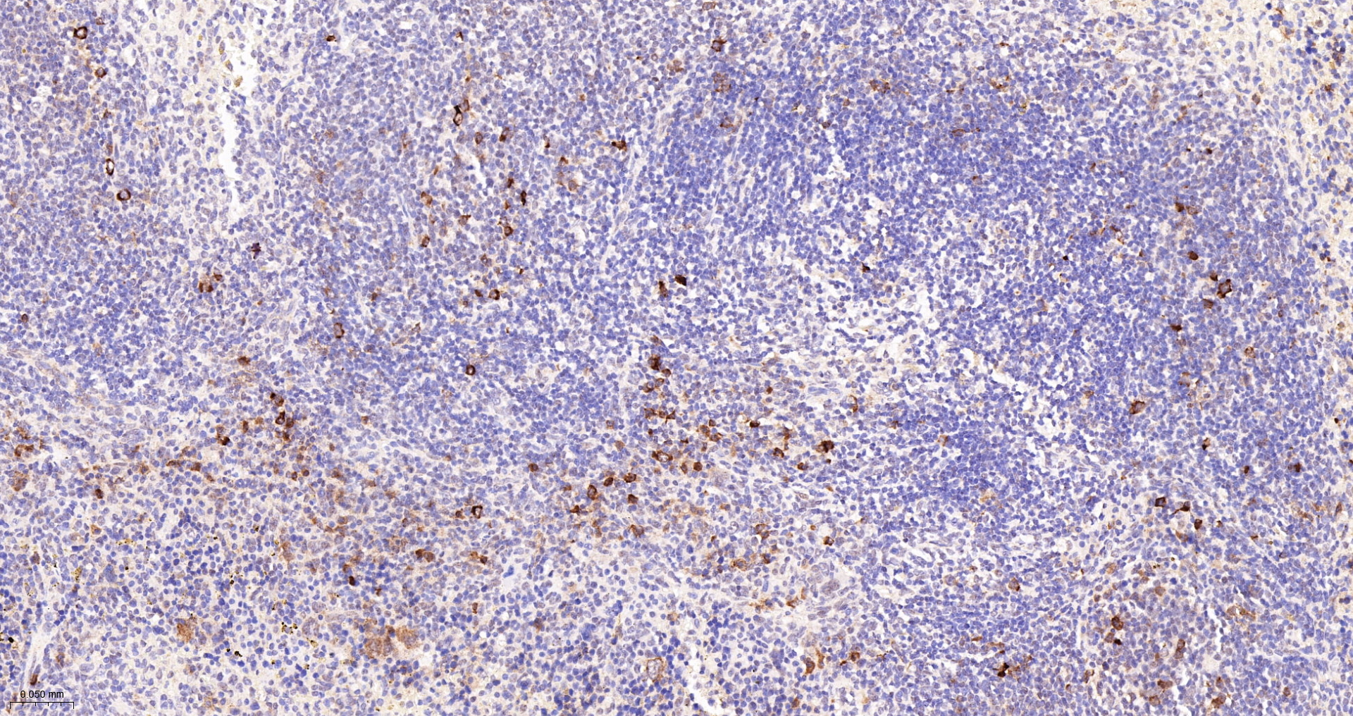 Phospho-RPS6 (Ser240 + Ser244) Polyclonal Antibody