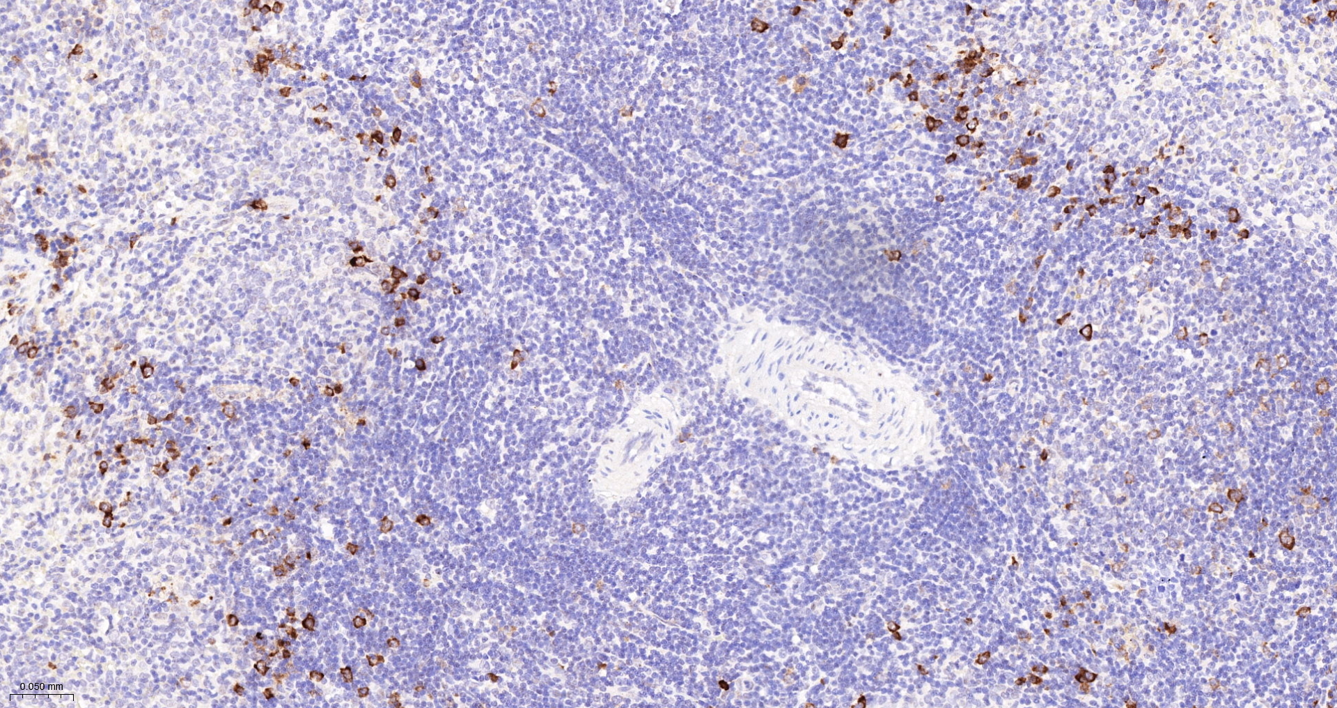 Phospho-RPS6 (Ser240 + Ser244) Polyclonal Antibody