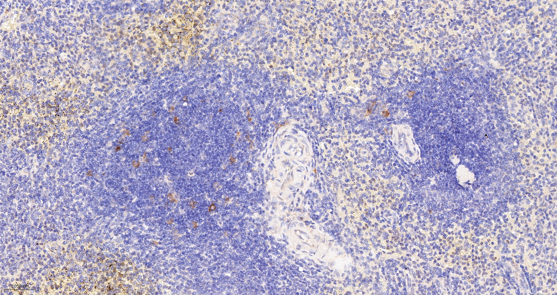Phospho-RPS6 (Ser240 + Ser244) Polyclonal Antibody