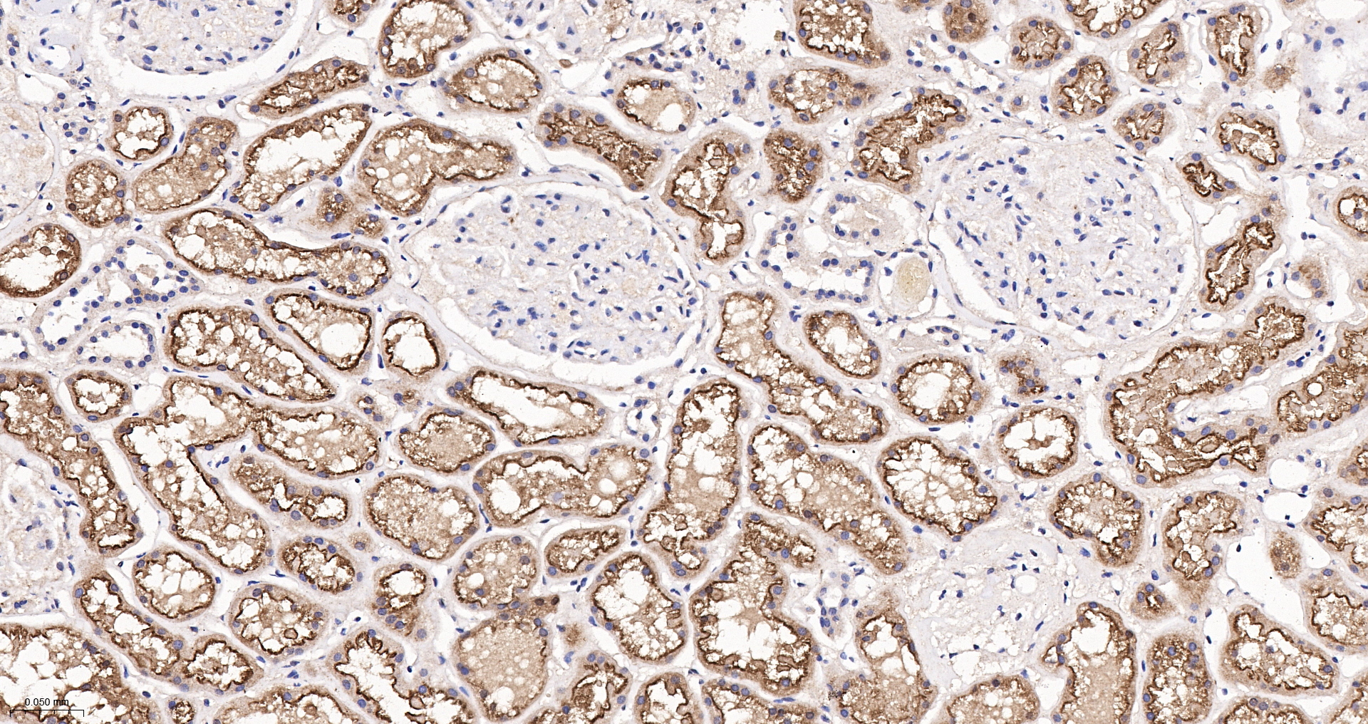 PDZK1 Recombinant Antibody