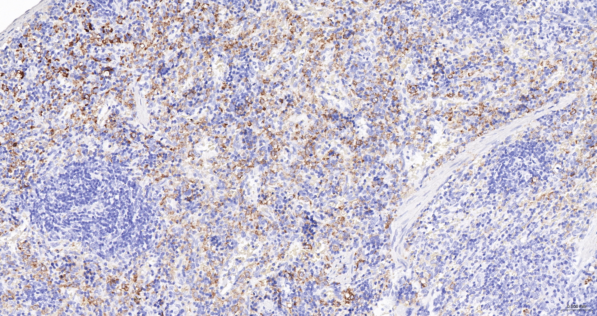 CD163 Recombinant Antibody, HRP Conjugated