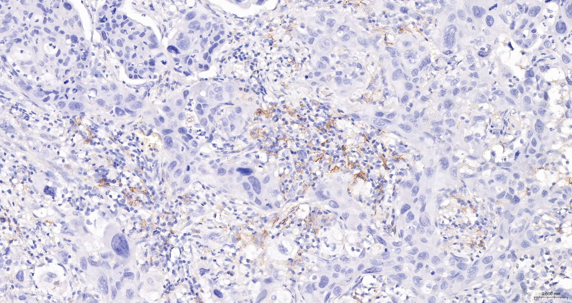 CD163 Recombinant Antibody, HRP Conjugated