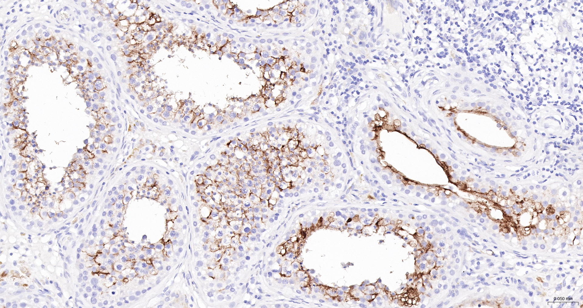ACE2 Polyclonal Antibody, HRP Conjugated