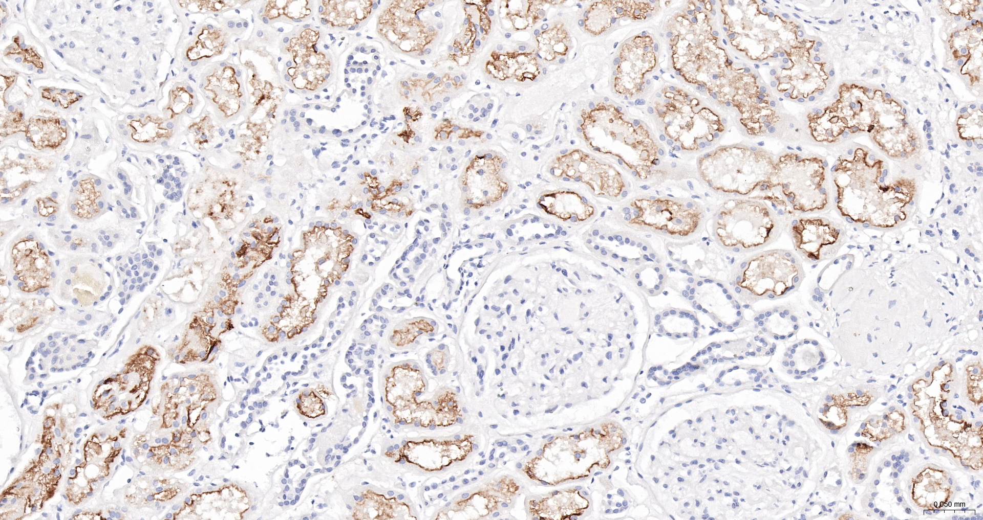 ACE2 Polyclonal Antibody, HRP Conjugated