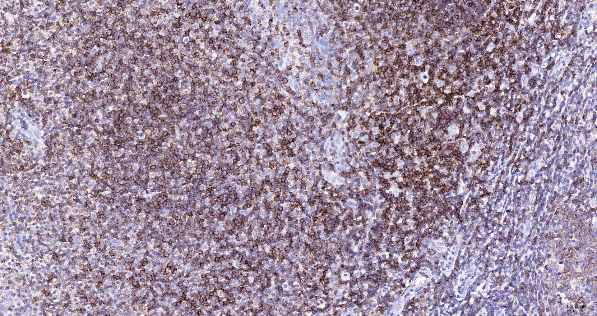 CD45 Polyclonal Antibody, HRP Conjugated