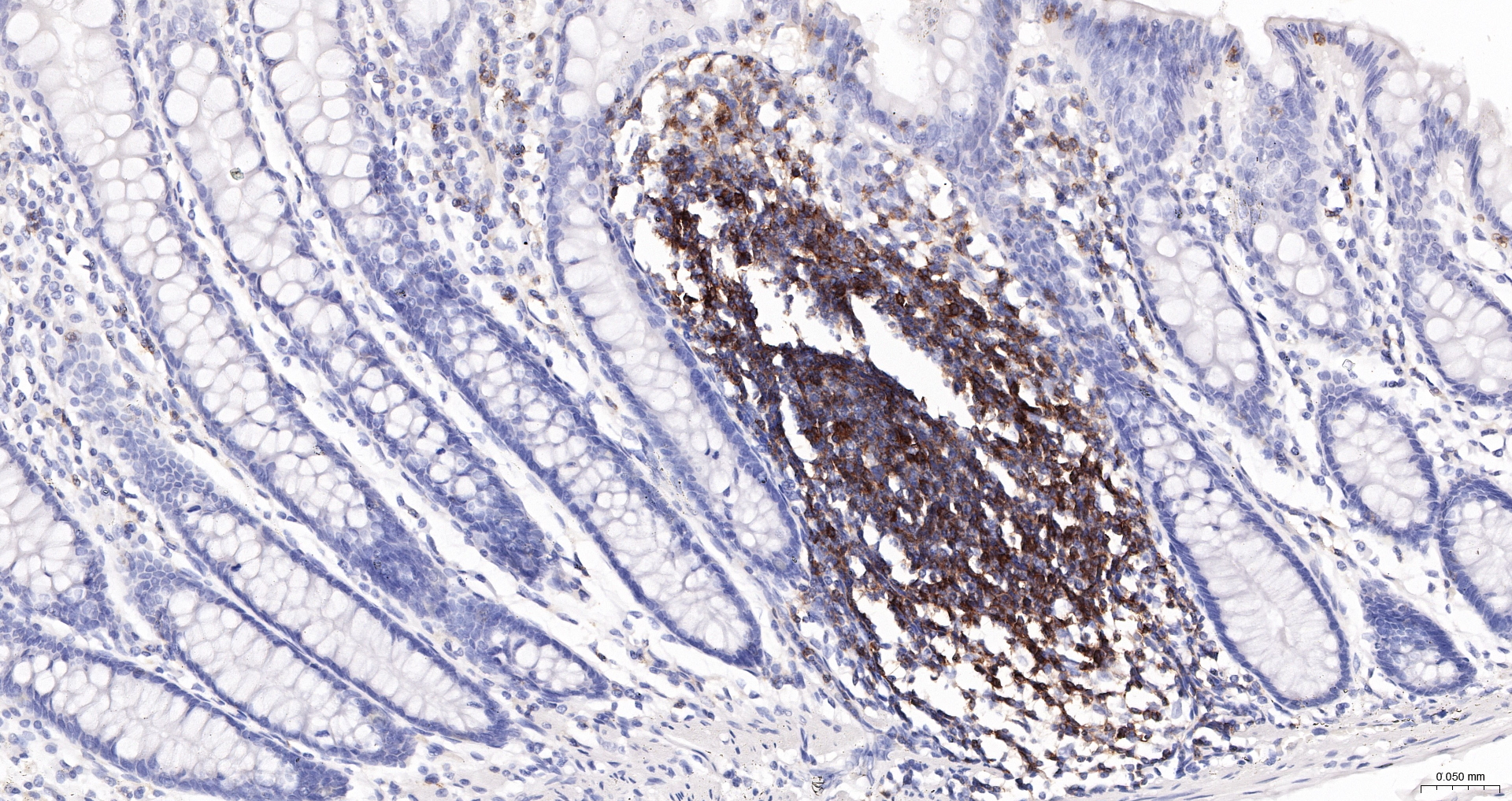 CD45 Polyclonal Antibody, HRP Conjugated