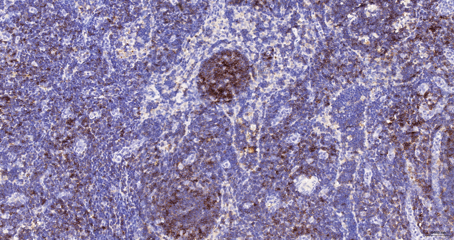 CD45 Polyclonal Antibody, HRP Conjugated