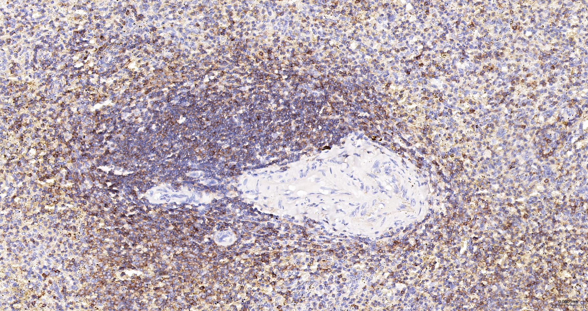 CD45 Polyclonal Antibody, HRP Conjugated