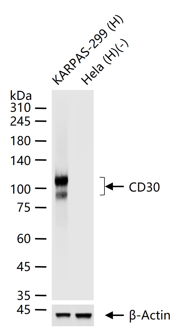 CD30 Monoclonal Antibody