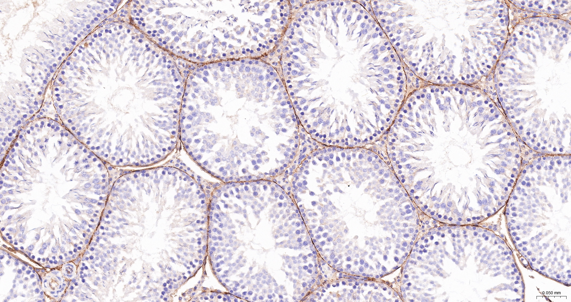 CD34 Polyclonal Antibody, HRP Conjugated