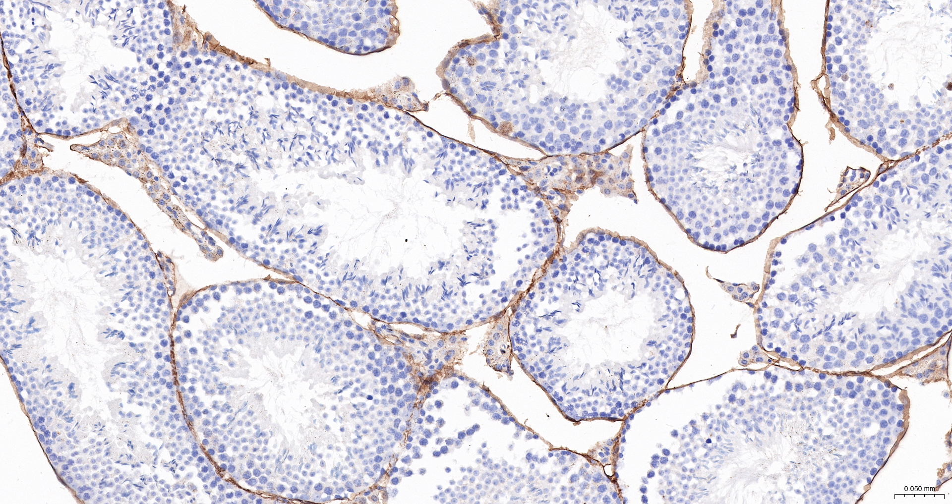 CD34 Polyclonal Antibody, HRP Conjugated