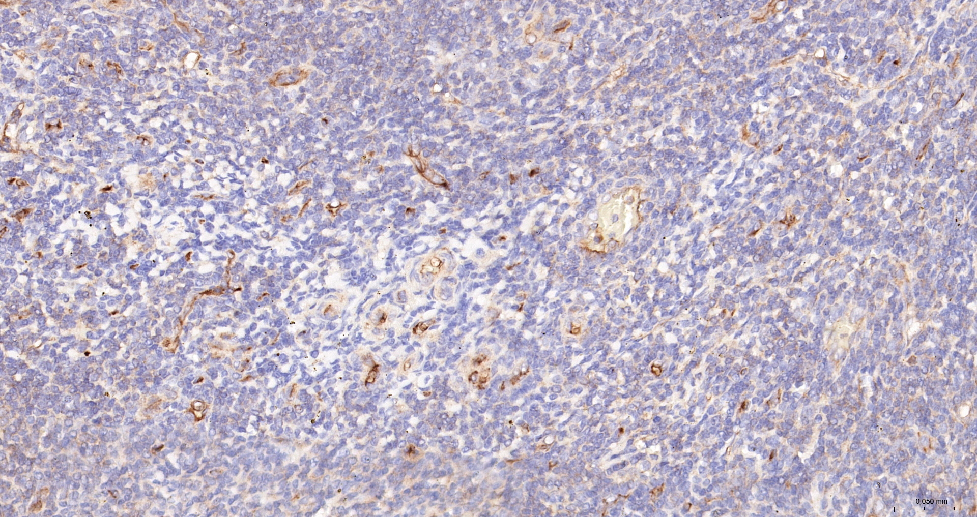 CD34 Polyclonal Antibody, HRP Conjugated