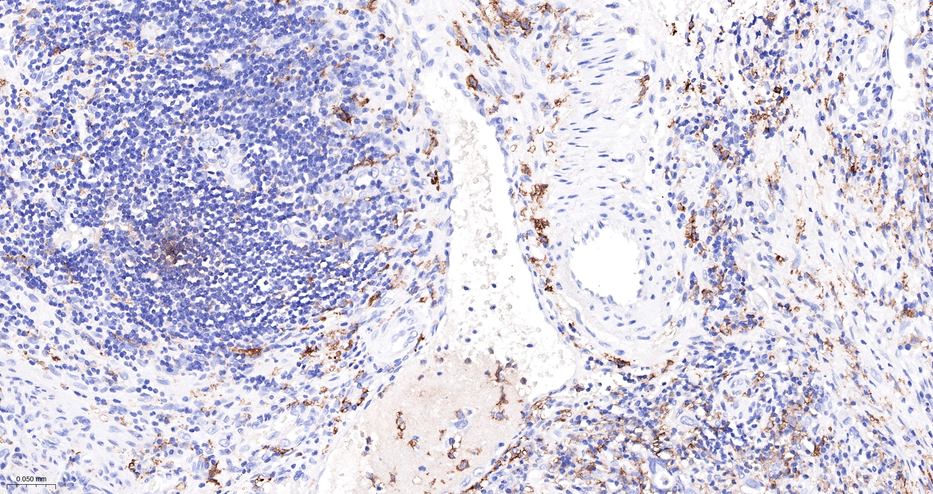 CD14 Monoclonal Antibody