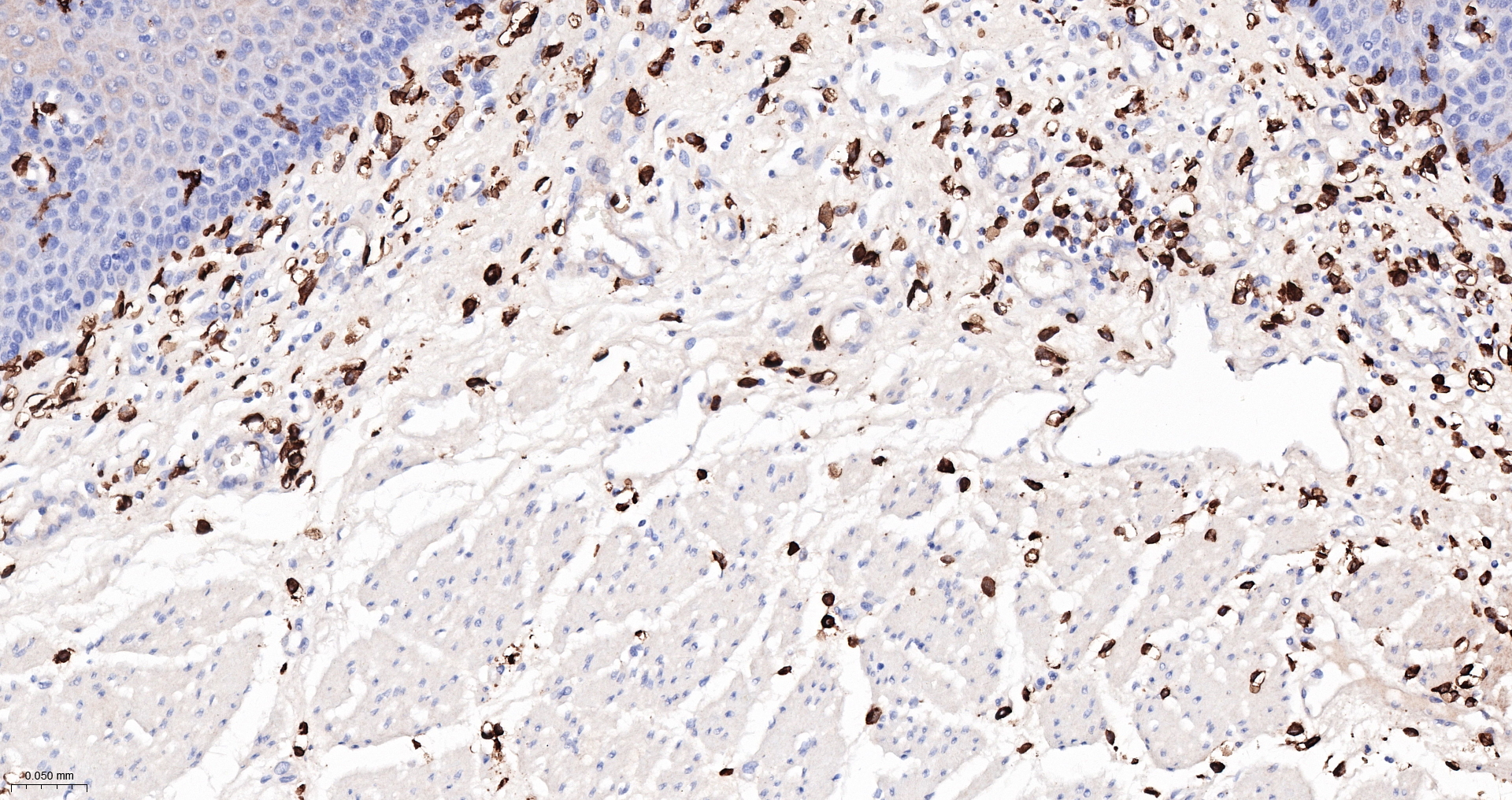 CD14 Monoclonal Antibody