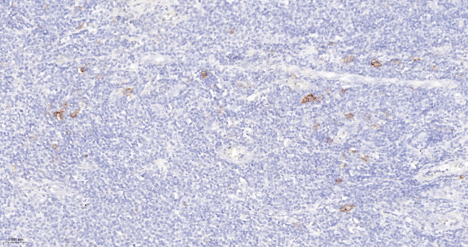 CD30 Monoclonal Antibody