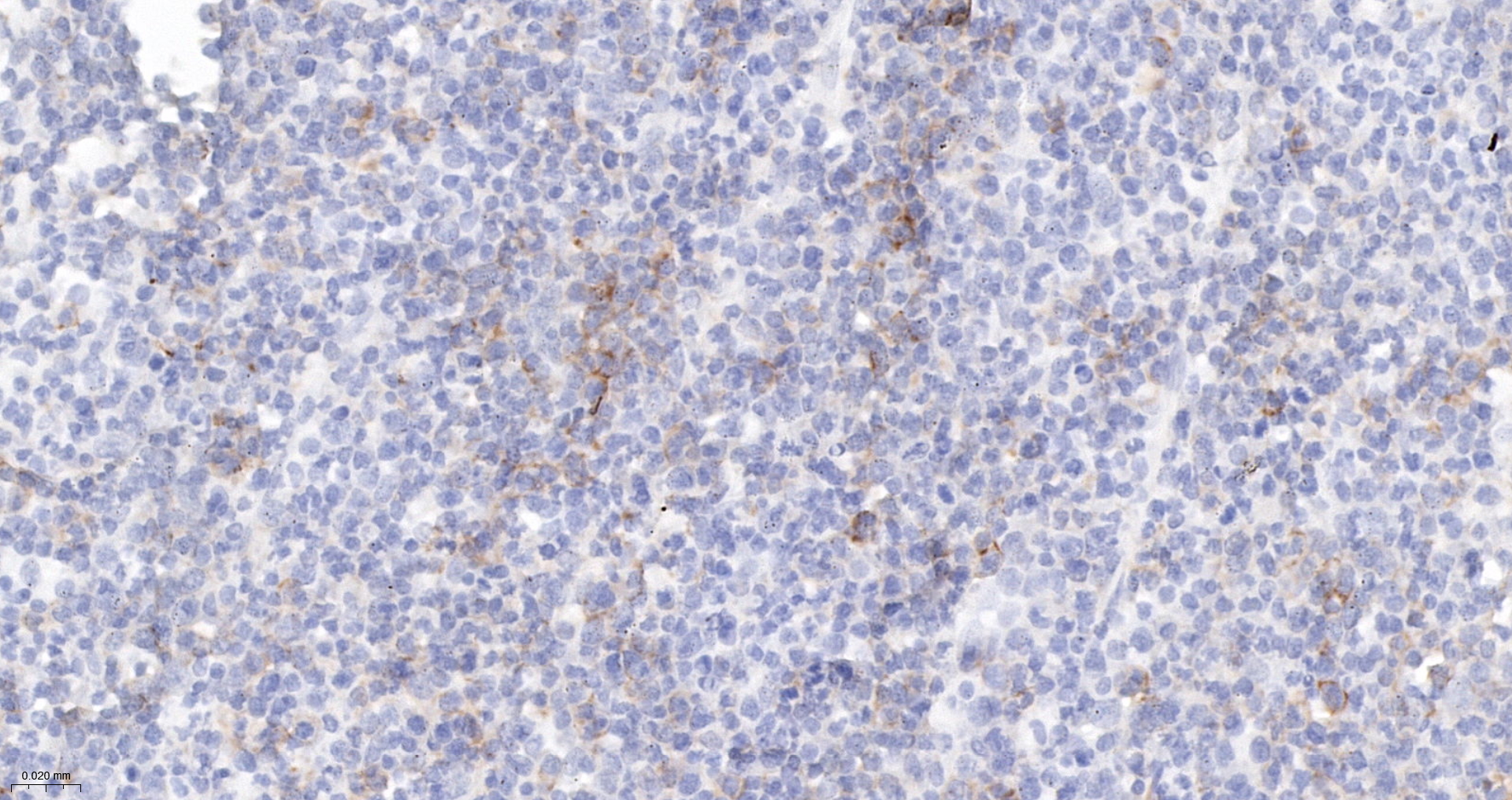 CD30 Monoclonal Antibody
