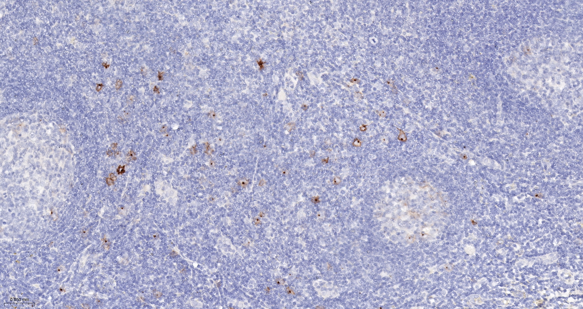 CD30 Monoclonal Antibody