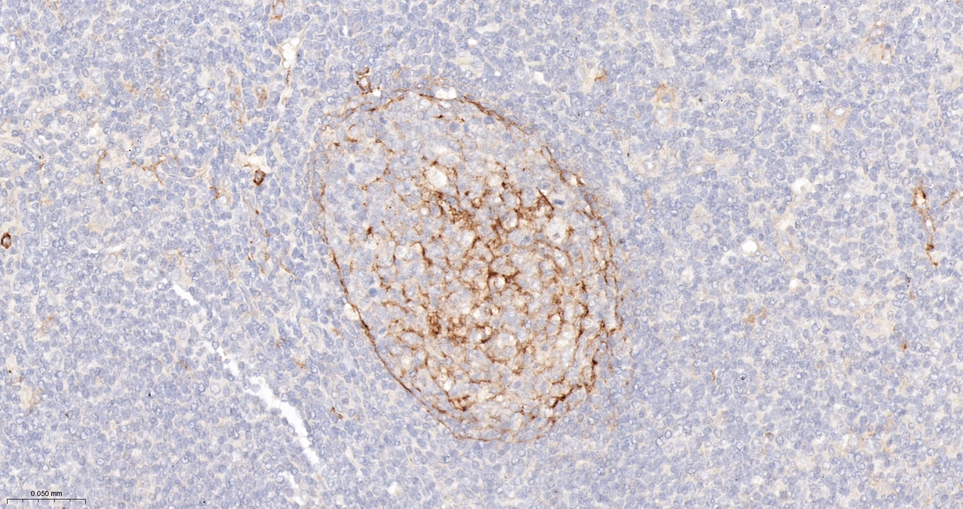 CD14 Monoclonal Antibody