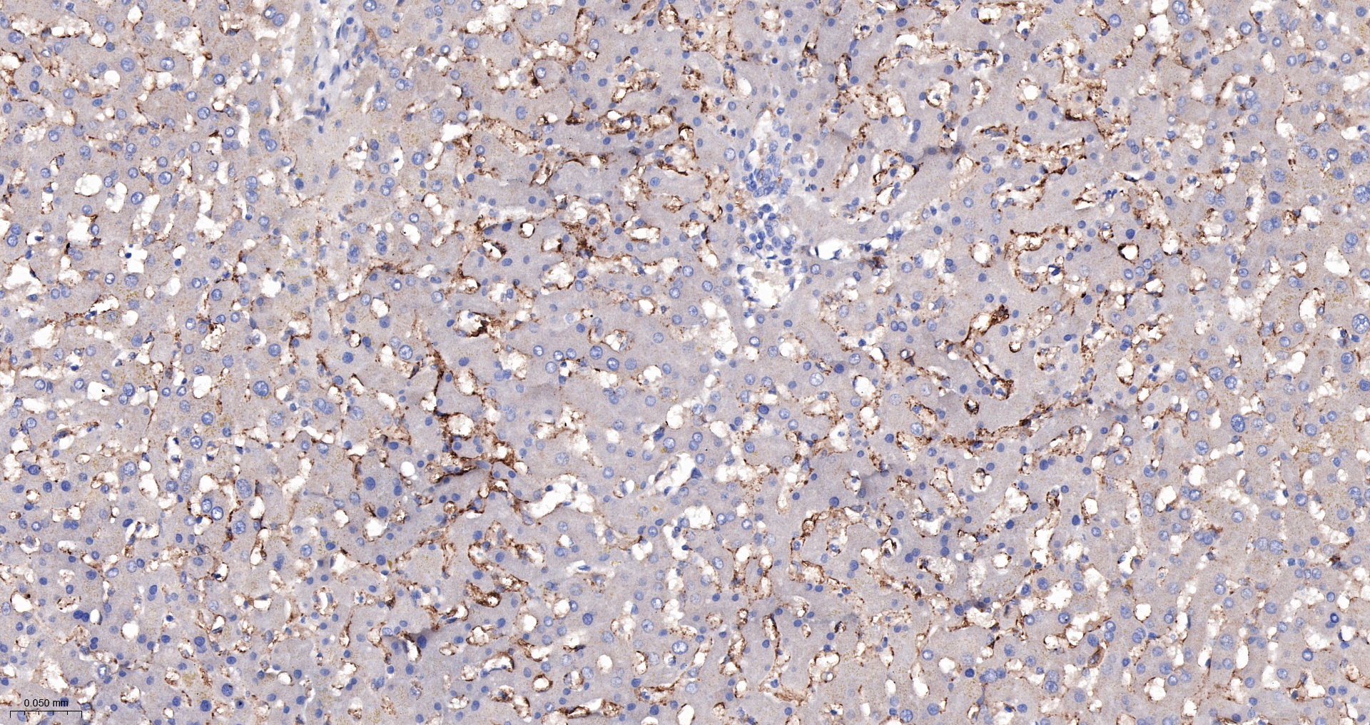 CD14 Monoclonal Antibody