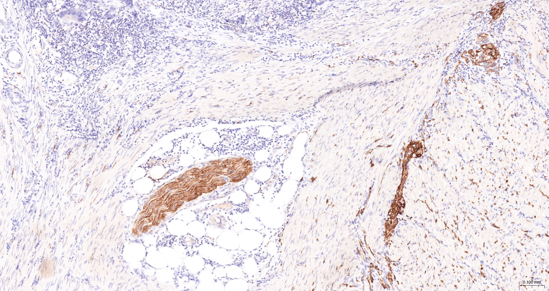 CD56 Monoclonal Antibody