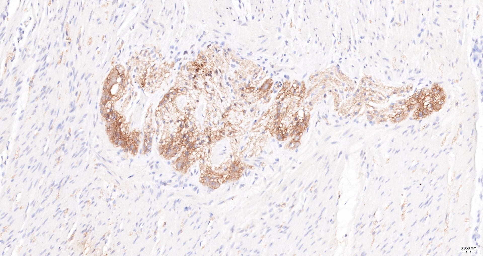 CD56 Monoclonal Antibody