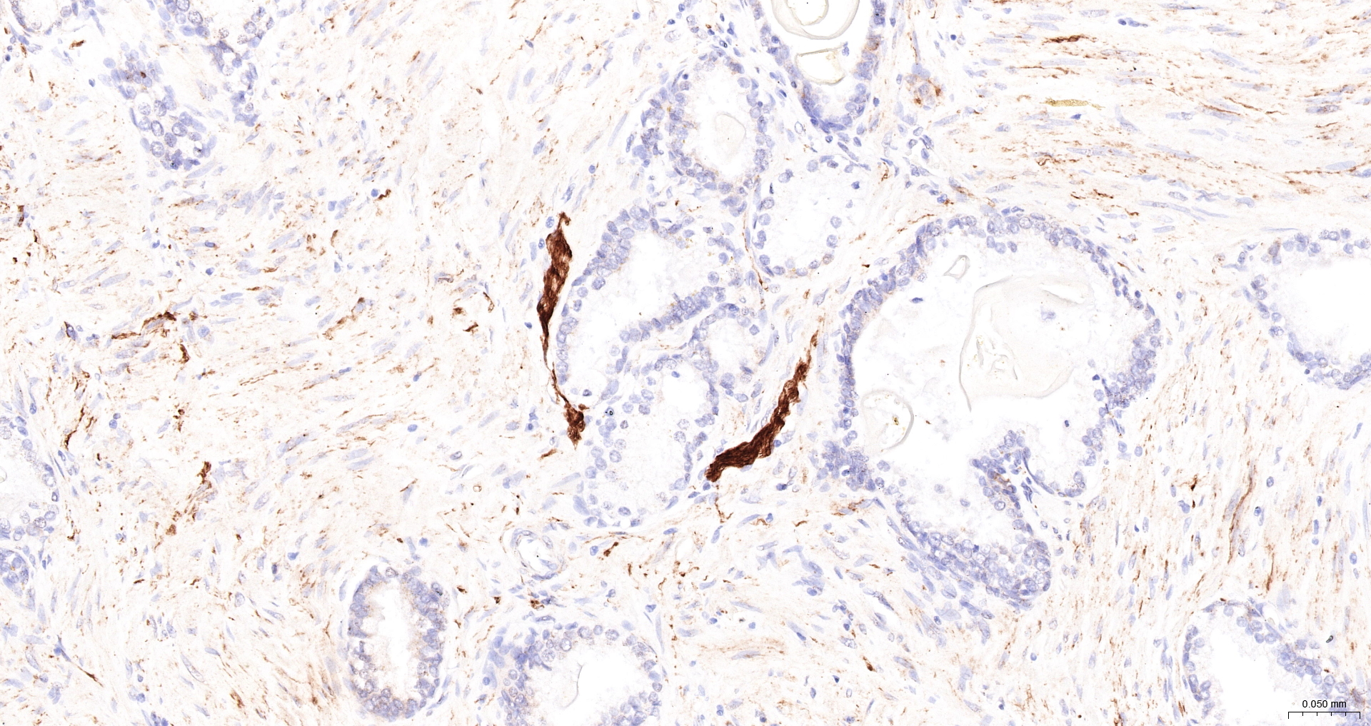 CD56 Monoclonal Antibody