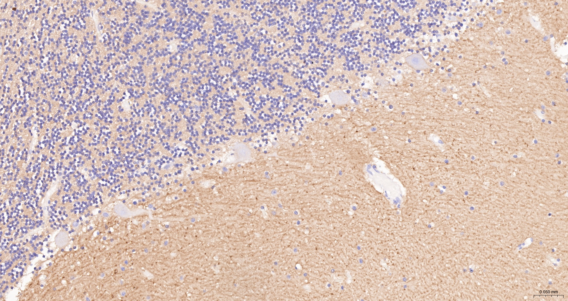 CD56 Monoclonal Antibody