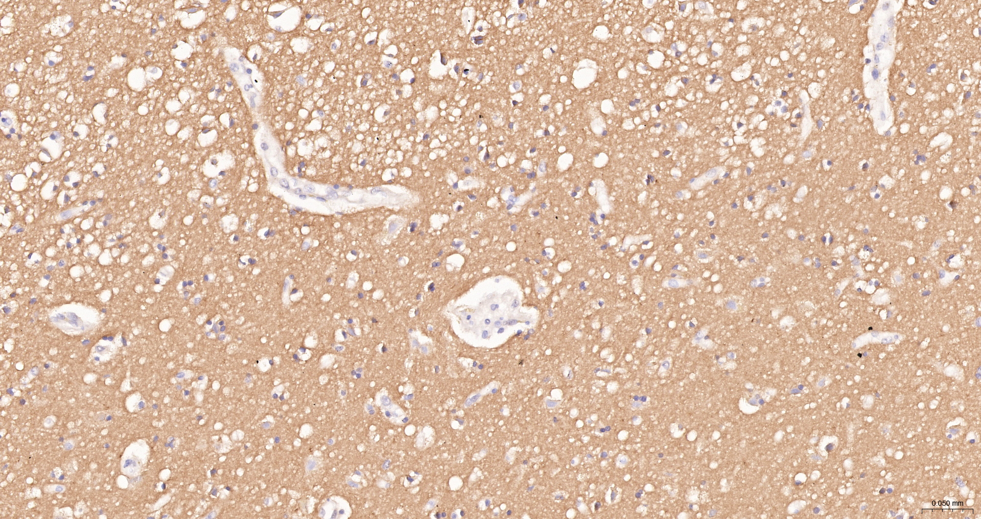 CD56 Monoclonal Antibody