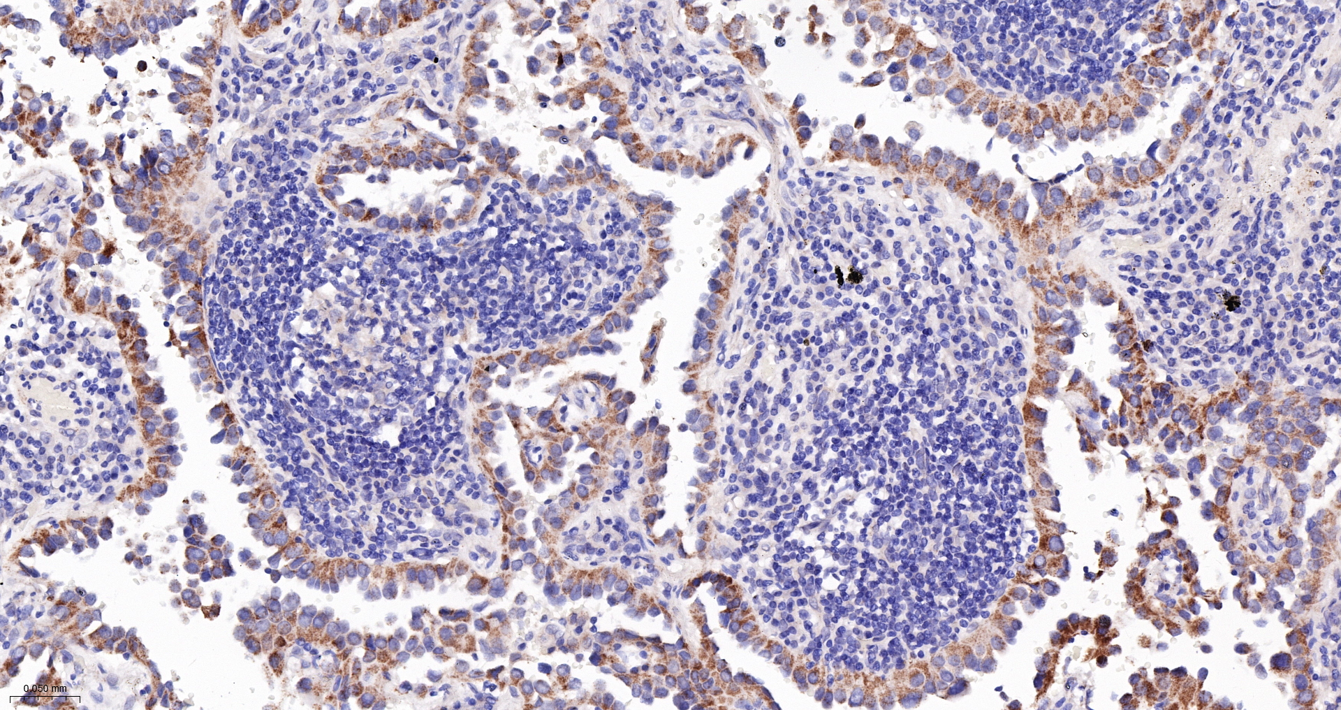 PCCB Monoclonal Antibody