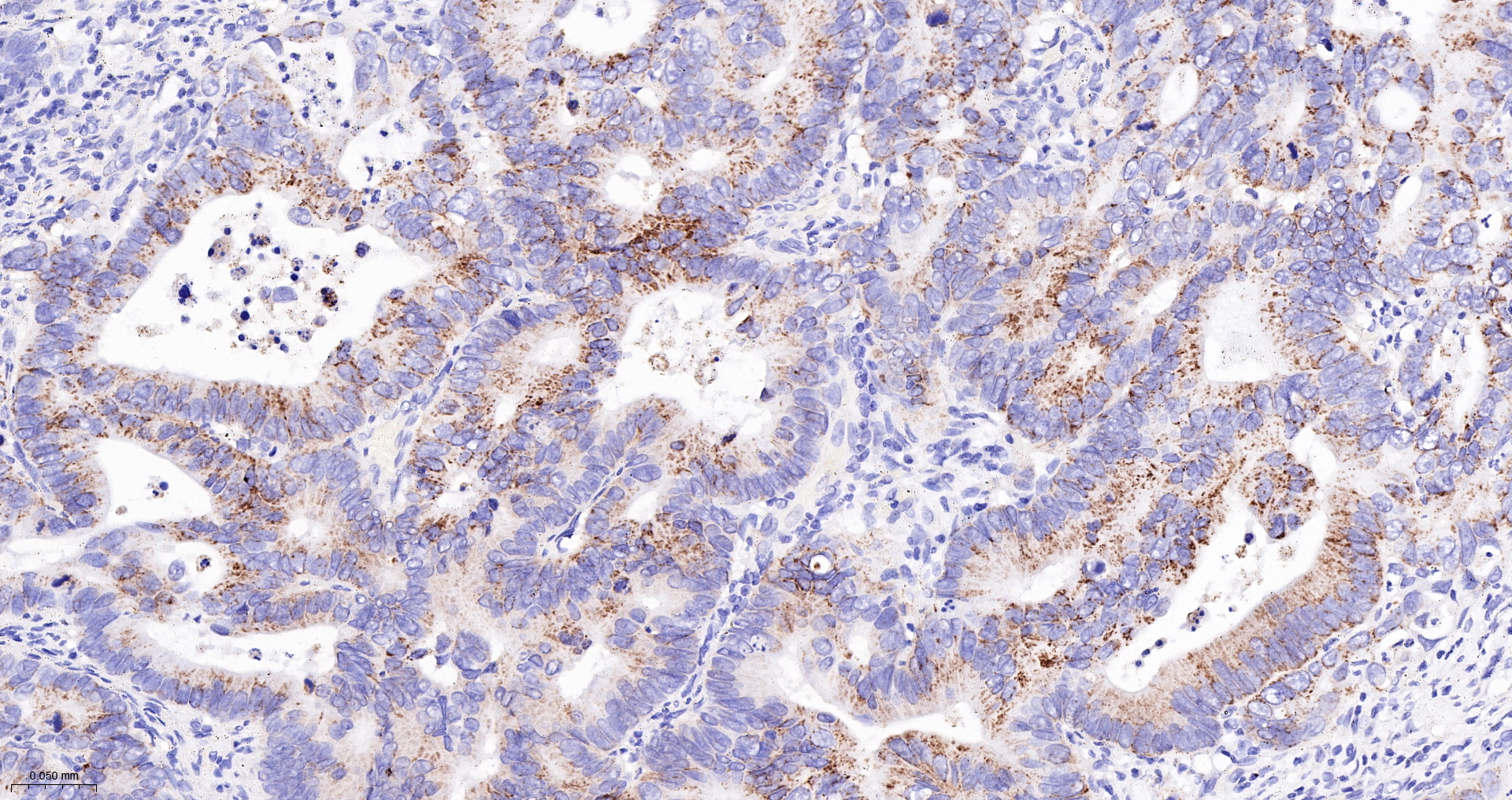 PCCB Monoclonal Antibody